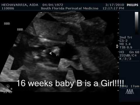 16 Weeks Pregnant Ultrasound Girl