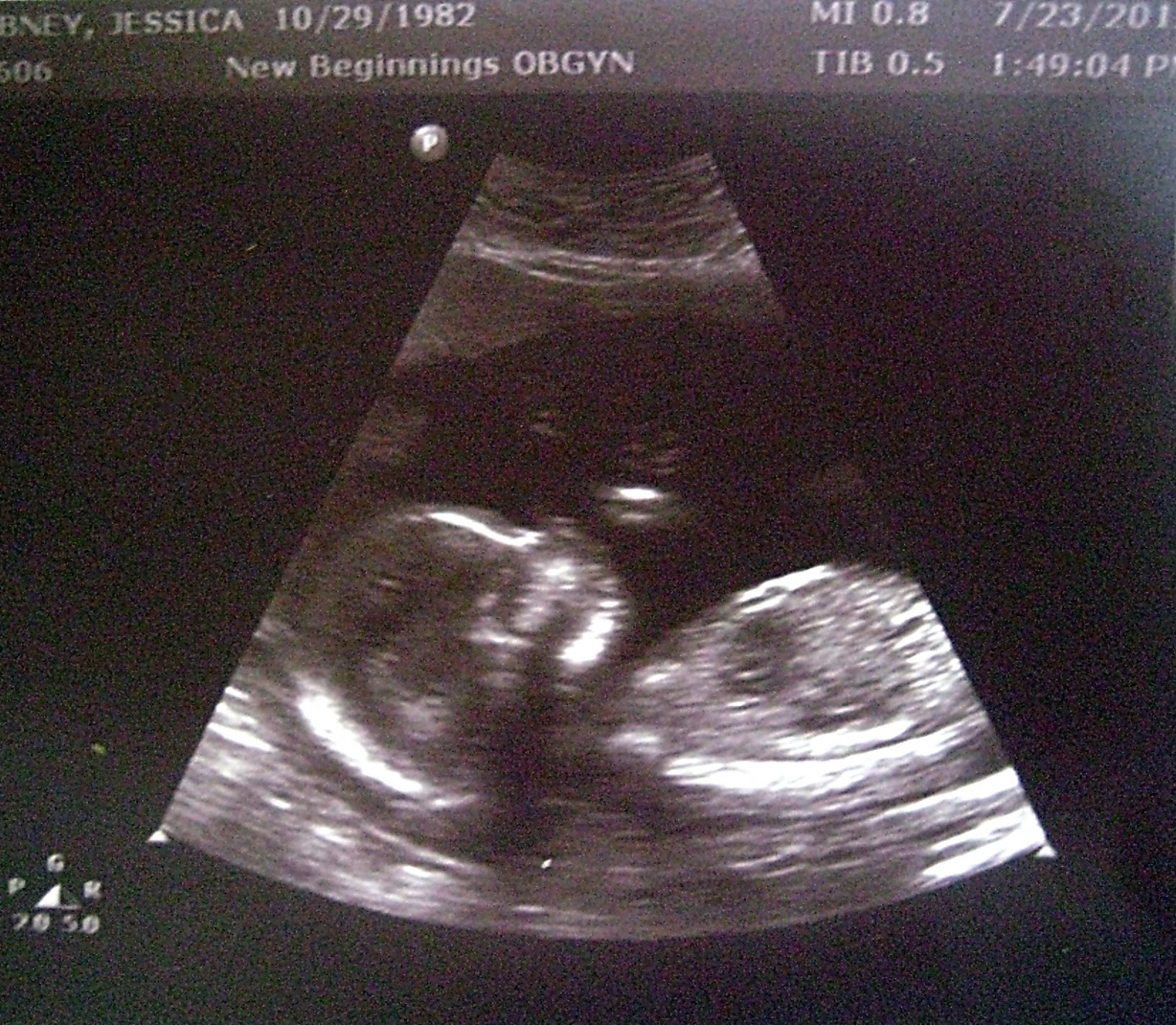 16 Weeks Pregnant Ultrasound Girl